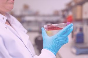 biopsia liquida cáncer de mama